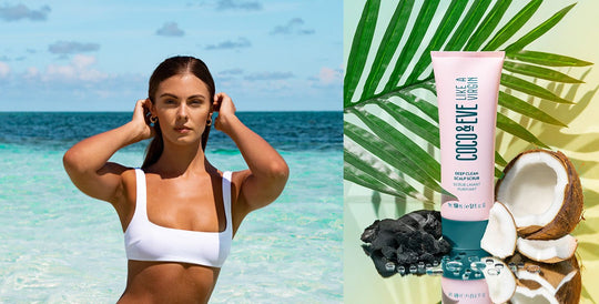Sunburn: Don't Let It Get to Your Head