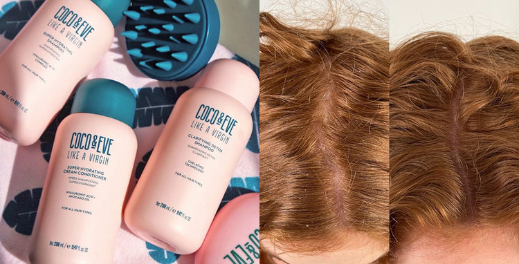 How to Fix Dry Scalp: Expert Tips and Remedies