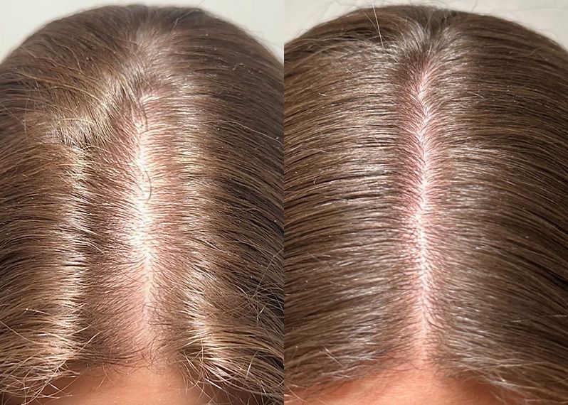 Review - hair @careaboutyour_hair