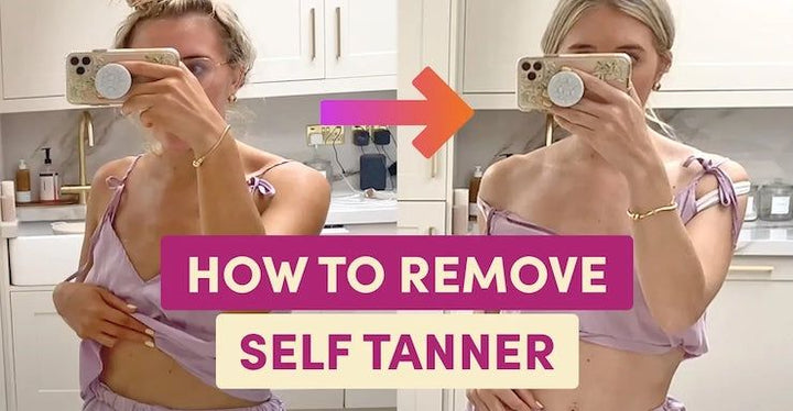 3 Steps to Remove Self Tanner Fast!